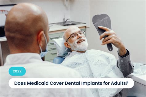 Does Medicaid Cover Adult Dental Implants in Your State